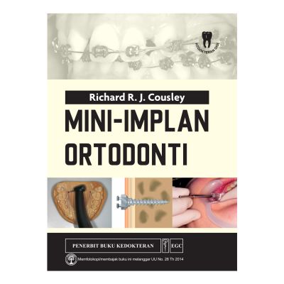 Mini-Implan Ortodonti