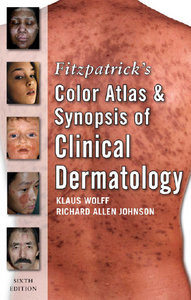 Fitzpatrick’s color atlas and synopsis of clinical dermatology