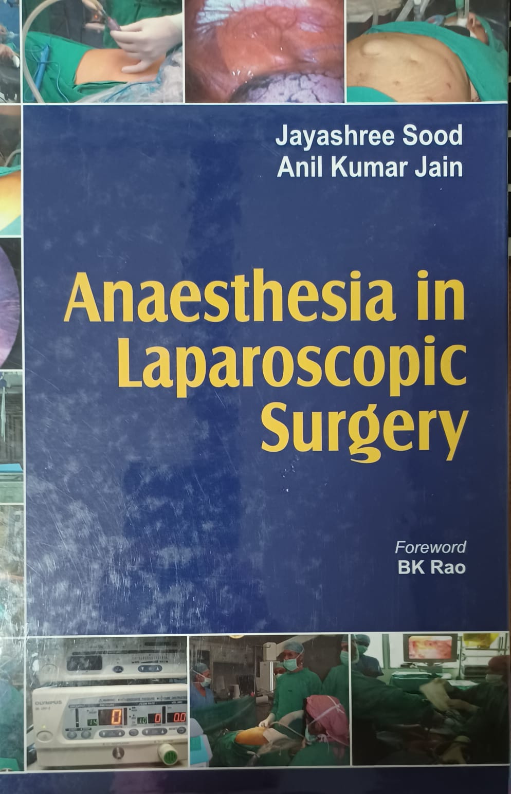 Anaesthesia in laparoscopic surgery