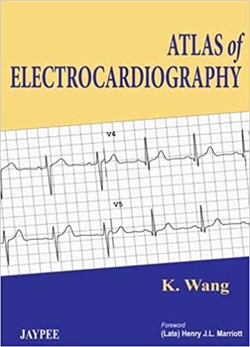 ATLAS of electrocardiography