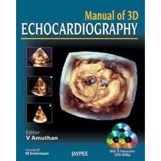 MANUAL of 3D echocardiography