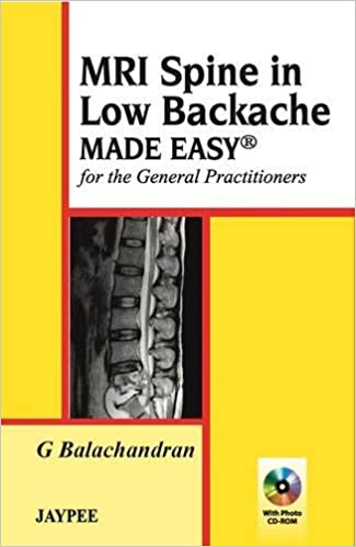 MRI spine in low backache made easy :  for the general practitioners