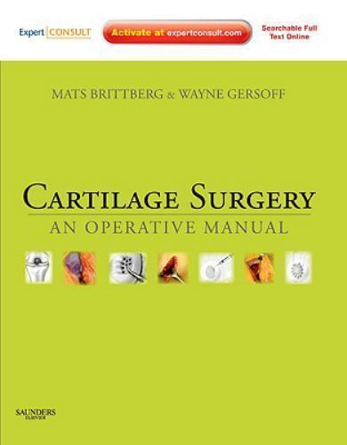 Cartilage surgery an operative manual